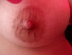 left nipple