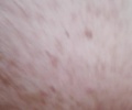mrd