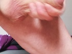 Pokračování.