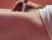 Dva týdny stažená předkožka - video č. 97767